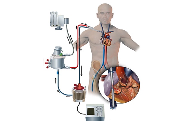 Mechanical Circulatory Support for the Expert Advanced Practice Provider (On Demand) - VAD Review for Cardiac Providers  Banner